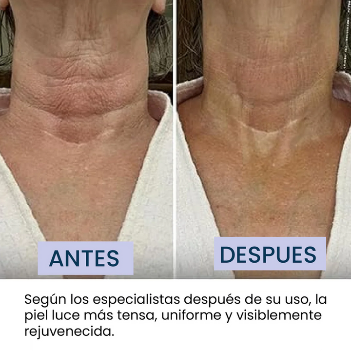 CREMA REPARADORA CUELLO